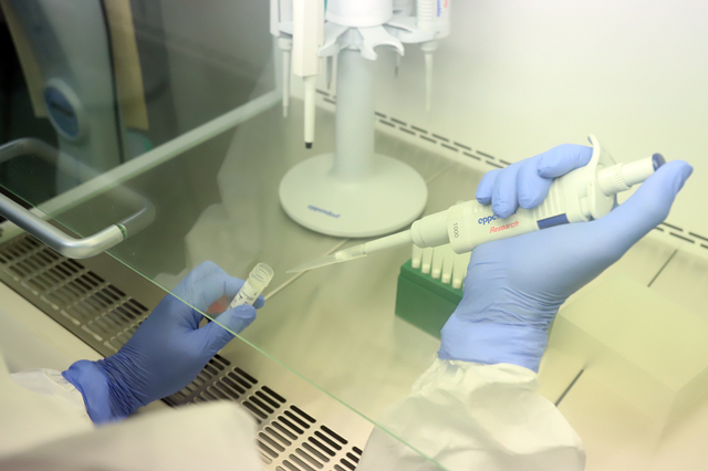 Tim Riset USK bekerja sama dengan Lembaga Eijkman melakukan penelitian terkait virus corona varian delta di Aceh. Foto: Dok. Humas USK