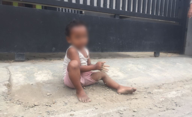 VF, balita berusia tiga tahun, di Kota Tegal punya kebiasan aneh.