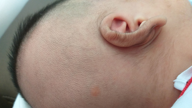 Ilustrasi bulu di telinga bayi atau lanugo. Foto: Shutter Stock