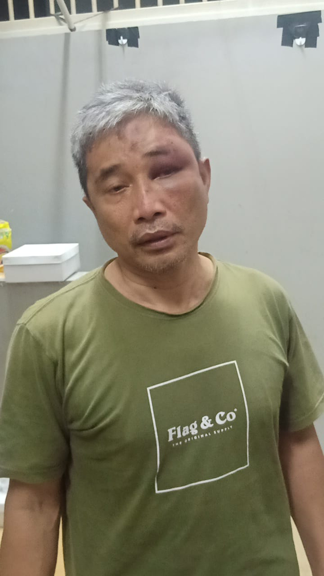 Muhammad Kece diduga dianiaya Irjen Napoleon di Rutan Bareskrim. Foto: Dok. Istimewa