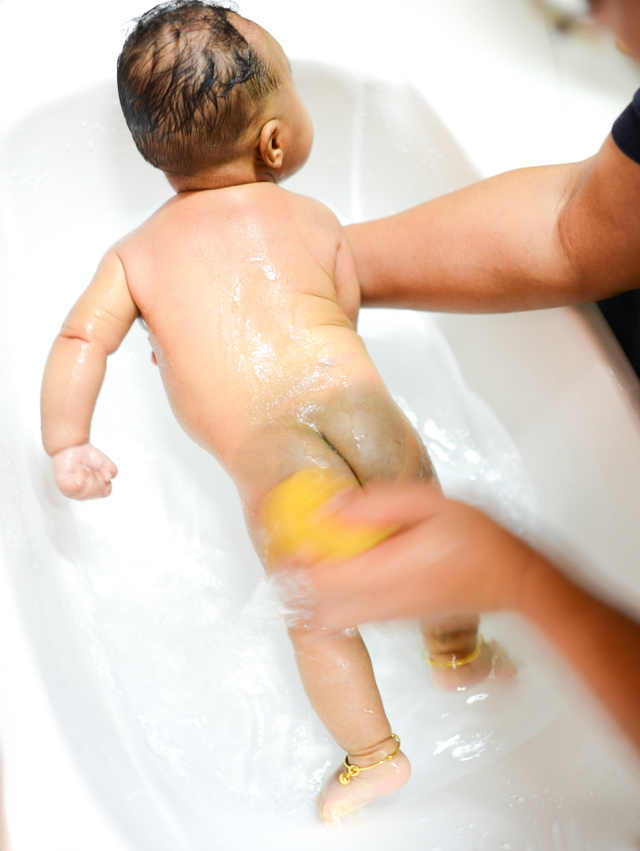 Tanda lahir bayi. Foto: Shutterstock