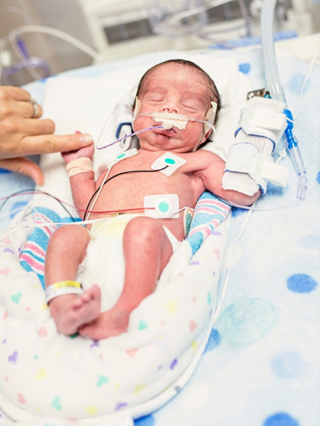 Bayi prematur. Foto: Shutter Stock