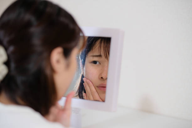 Skin Barrier Rusak. Foto: Pixabay