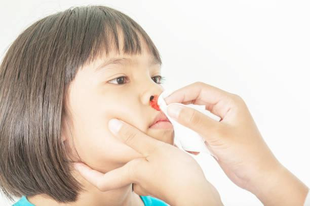 Ilustrasi penyebab mimisan pada anak secara tiba-tiba (Sumber: Pexels)