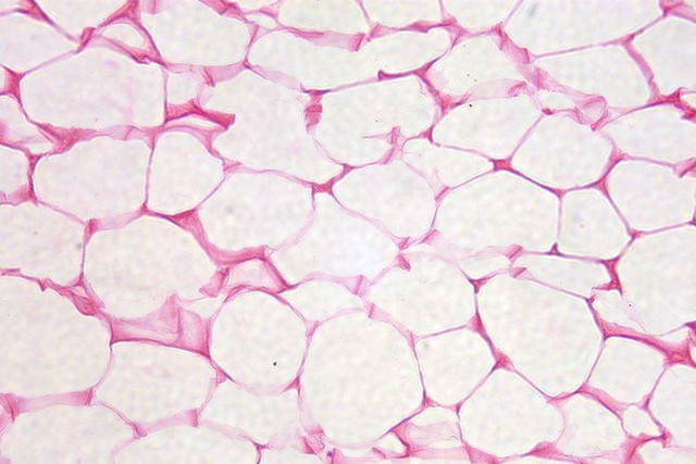 Ilustrasi jaringan adiposa. Foto: Pixabay