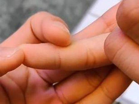 Pinky Dent. (Foto: @gsolution_id/TikTok)