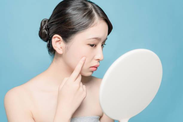 Cara Mengatasi Kulit Bertekstur. Foto: iStockphoto