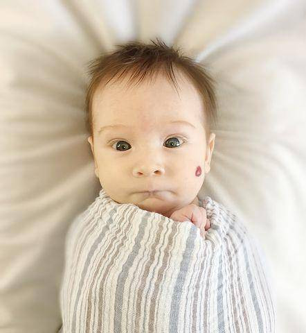 Ilustrasi bayi dengan tanda lahir. Foto: pixabay
