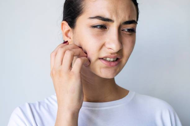 Muka Gatal Saat Memakai Skincare. Foto: iStockphoto