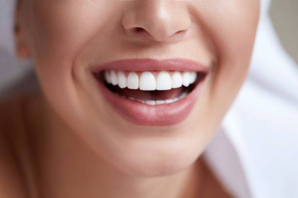 Cara Menghilangkan Garis Senyum Secara Alami. Foto: iStockphoto