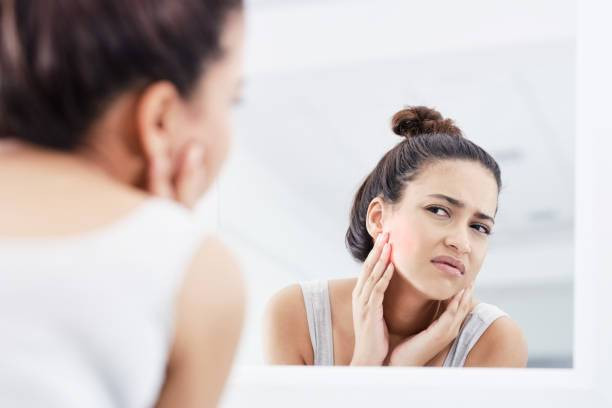 Tanda Skincare Tidak Cocok. Foto: iStockphoto