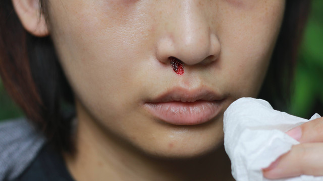 Ilustrasi orang dewasa mimisan. Foto: Wonderplay/Shutterstock