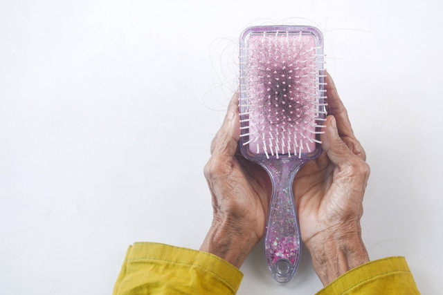 Ilustrasi Tutorial Cara Cepat Menumbuhkan Rambut Botak dalam 1 Minggu yang Paling Ampuh. (Foto: Towfiqu Barbhuiyak | Unsplash.com)