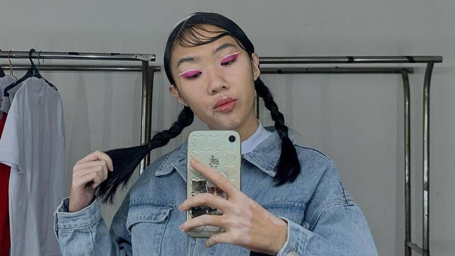 Vitiligo Model, Zsazsa. Foto: Instagram/@zsazsimi