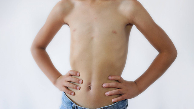 Ilustrasi Anak dengan Tubuh Kurus. Foto: Ketolina/shutterstock