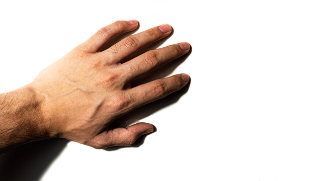 Ilustrasi urat tangan menonjol. Foto: Unsplash