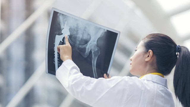 ilustrasi pemeriksaan tulang. Foto: Shutter Stock