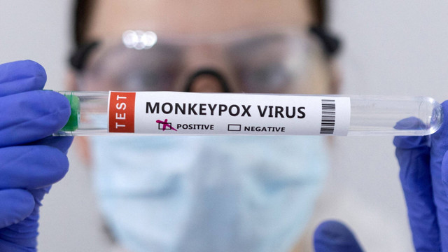 Ilustrasi virus Monkeypox atau cacar monyet. Foto: Dado Ruvic/REUTERS