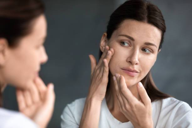 Ilustrasi contoh skin barrier rusak (Sumber: Pexels)