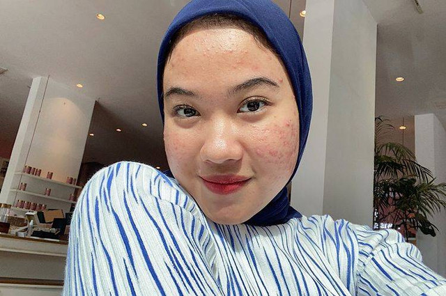 Skincare & Makeup Enthusiast, Ratu Ghania. Foto: Instagram @ratughania