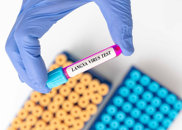 Ilustrasi positif virus Langya. Foto: Shutterstock