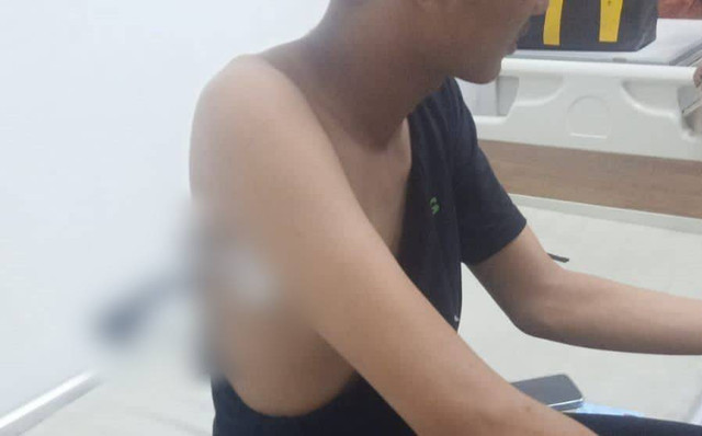 AR saat mendapatkan pertolongan medis usai dibusur OTK di Jembatan Teluk Kendari.