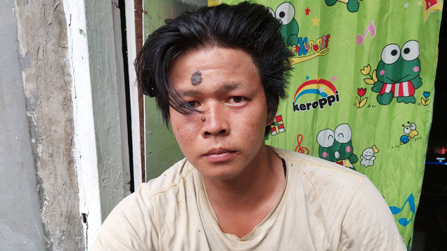 Rahmat, warga Jalan Tipar Timur, Jakarta Utara, yang terkena ledakan granat kejut, pada Rabu (28/9/2022). Foto: Fachrul Irwinsyah/kumparan