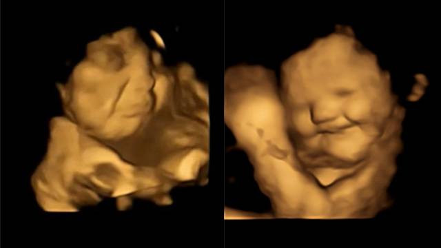 USG bayi berekspresi (Foto: Prof. Jackie Blissett/@profblissett/Twitter)