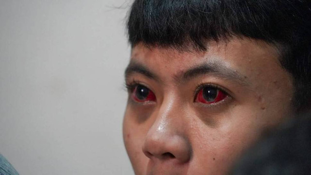 Temuan TGIPF: Korban Tragedi Kanjuruhan Alami Pendarahan Mata hingga Trauma