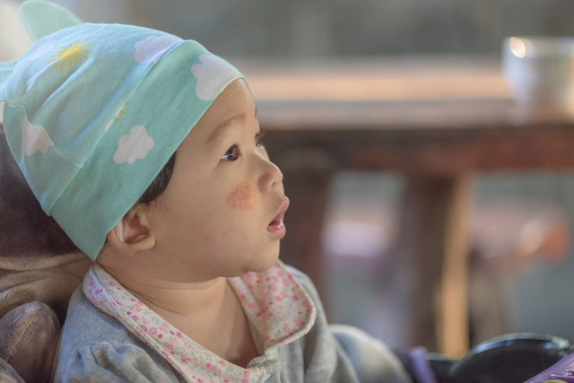 Ilustrasi luka bakar pada anak.  Foto: tinglee1631/Shutterstock