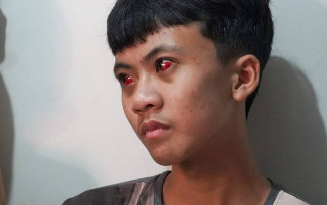 Aremania Tantang Polisi Rasakan Efek Gas Air Mata