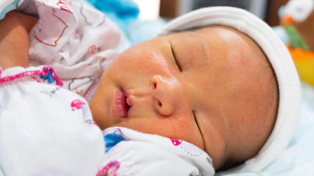 Ilustrasi penyakit kuning pada bayi. Foto: Bonn_A/Shutterstock