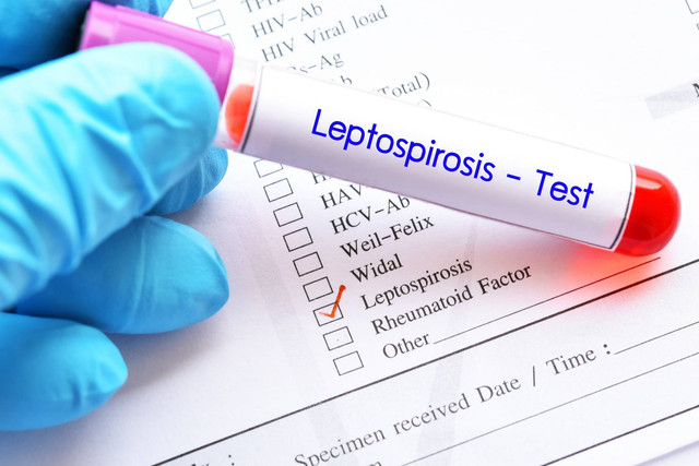 Ilustrasi Liptospirosis atau kencing tikus. Foto: Jarun Ontakrai/Shutterstock