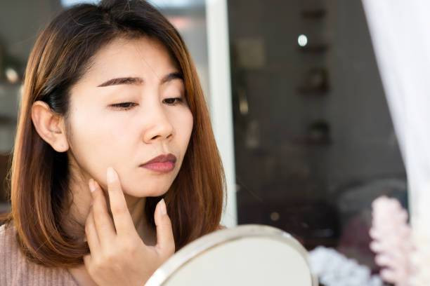 Ilustrasi penyebab bibir hitam (Sumber: Pexels)