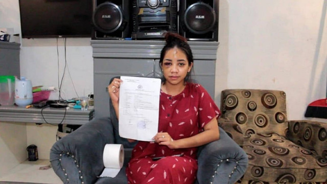 Korban mengalami luka lebam di area mata diduga dianiaya pacar (DEFRI CANDRA/SELASAR RIAU)