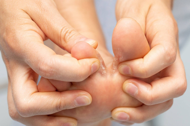 Ilustrasi penyakit kaki atlet pada ibu hamil. Foto: sruilk/Shutterstock