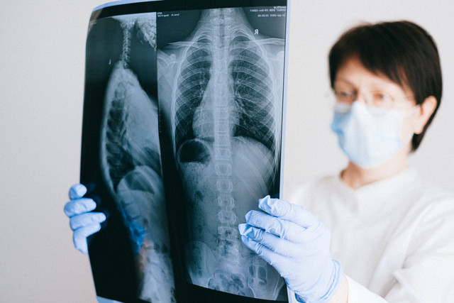 Pembersihan paru-paru adalah teknik yang dilakukan untuk mengeluarkan benda asing dari paru-paru. Foto: Pexels.com 