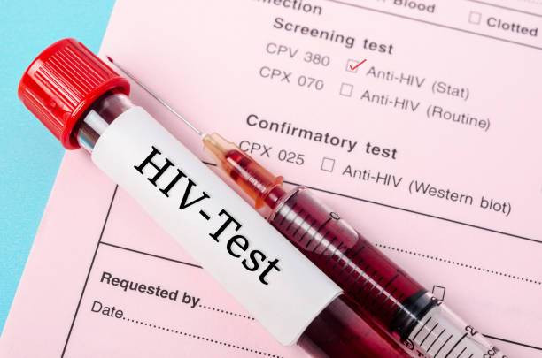 Ilustrasi HIV. Foto: Shutterstock