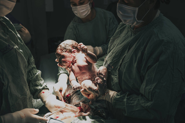 Ilustrasi operasi caesar berapa jam? Foto: Pexels