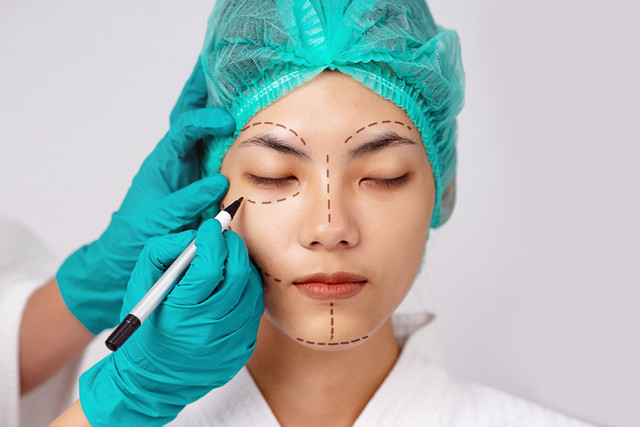 Ilustrasi operasi plastik. Foto: Shutterstock