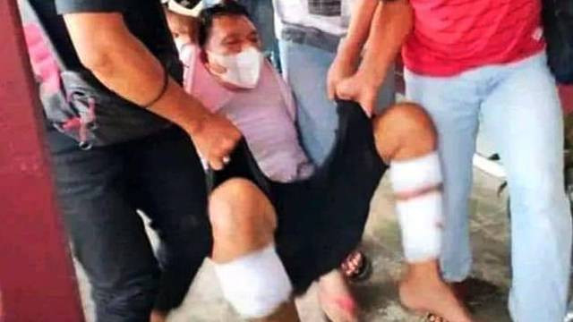 JT alias Jemi, terduga pelaku pembunuhan seorang anak usia 5 tahun di desa Inuai Bolmong, harus ditembak polisi di bagian kaki untuk melumpuhkannya setelah mencoba kabur.