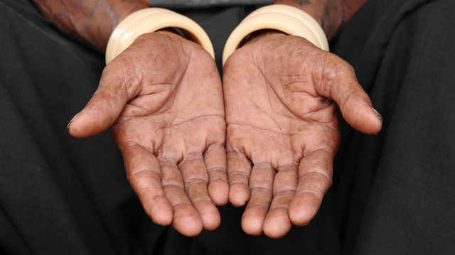 Ilustrasi hukum mengemis atau meminta-minta (Pexels).