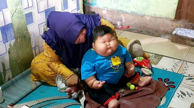 Kenzie, balita 1 tahun 4 bulan dengan berat badan 27 kg. Foto: kumparan