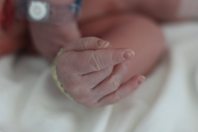  Ilustrasi pada bayi. Foto: Shutterstock