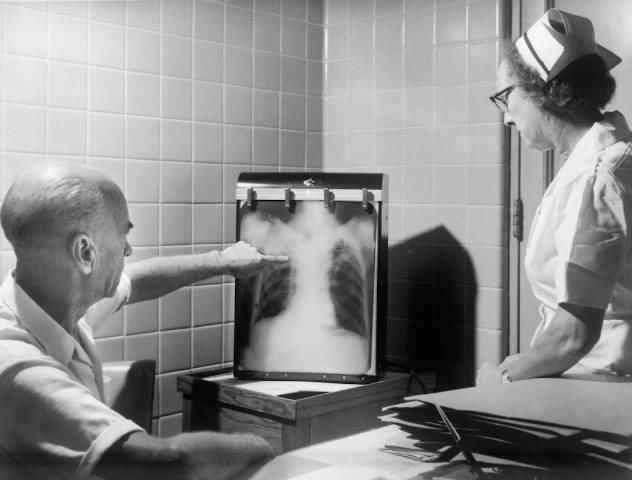 Ilustrasi Ucapan Hari Tuberkulosis Sedunia 2023, Penyakit Akibat Infeksi. Foto: Unsplash.