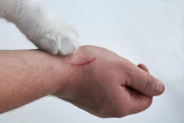 Ilustrasi Bartonella henselae, penyakit cakaran kucing.
Foto: Shutterstock