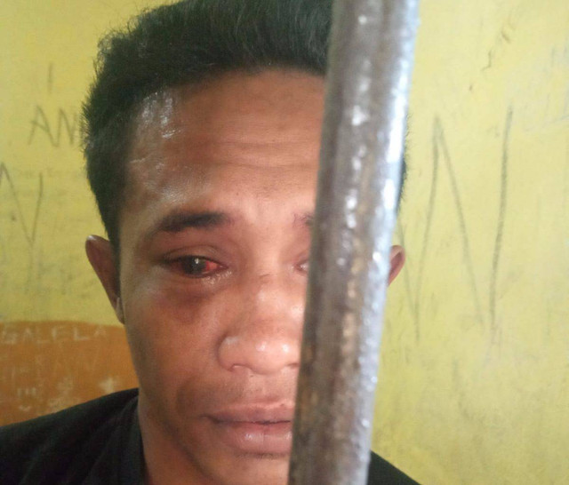 Kondisi korban saat ini setelah diduga dianiaya 2 oknum polisi. Foto: Istimewa