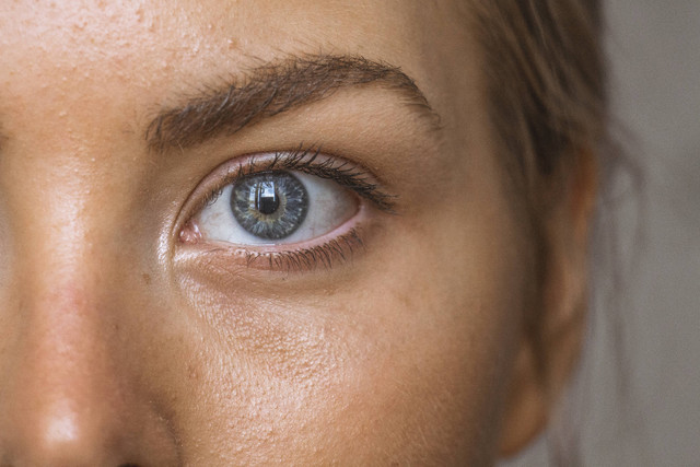 Ilustrasi Cara Menghilangkan Bruntusan di Pipi. Foto: Unsplash/Amanda Dalbjörn.