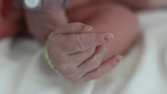 Viral Kulit Bayi Penuh Bercak Cokelat, Tanda Lahir atau Kondisi Medis? Foto: DonyaHHI/shutterstock