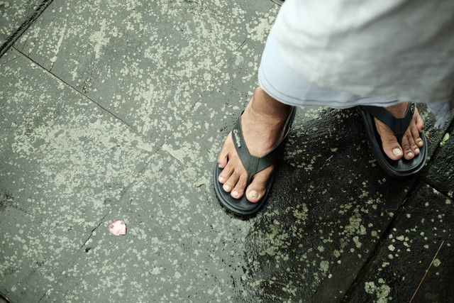 Ilustrasi cara mengobati kutu air yang paling ampuh. Foto: Unsplash/Aditya Nara